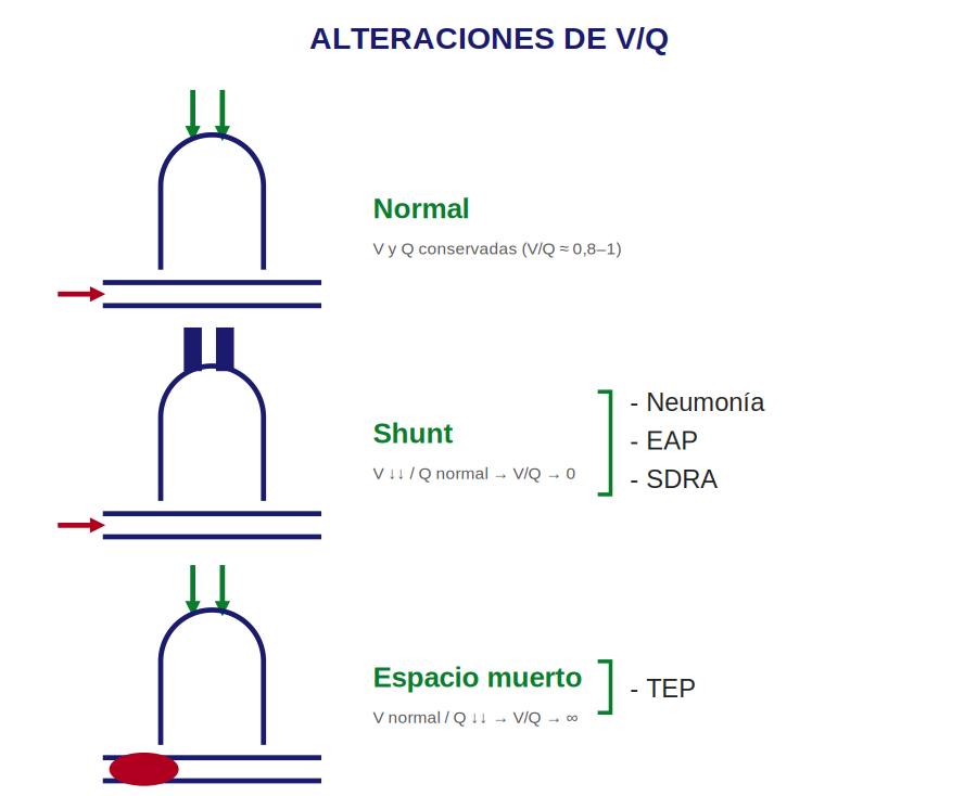 Alteraciones de V/Q: normal, shunt y espacio muerto